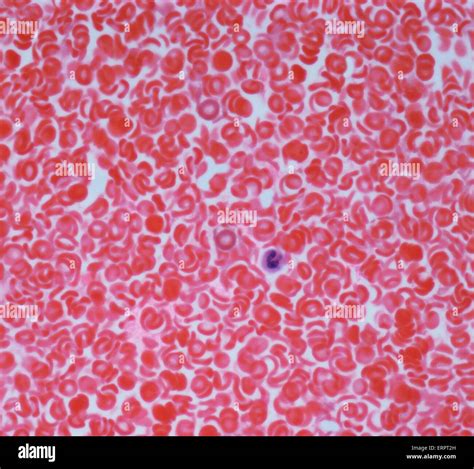 Blood Light Micrograph Of Red Blood Cells Erythrocytes Red In A