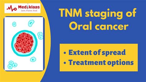 Tnm Staging Of Oral Cancer L Oral Surgery L Mediklaas Youtube