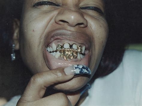 Wepresent The History Of Eddies Famous Gold Teeth