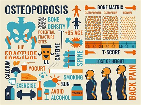 Serial Bmd Tests Show Osteoporosis Drug Effects Fracture Risk