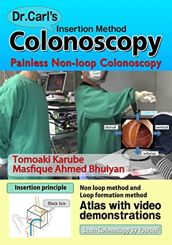 Dr Carls Colonoscopy Insertion Method Ebook Karube Tomoaki Amazon