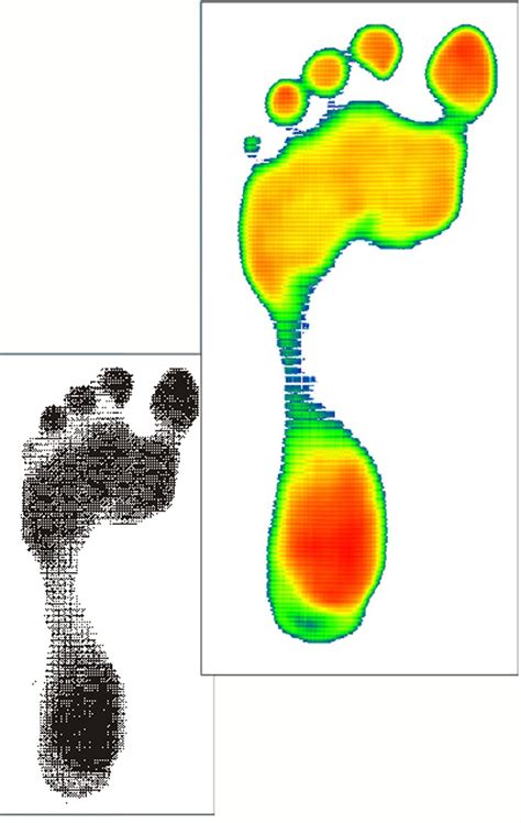 Semi Automatic Plantar Pressure Foot Scan Podiascan For Hospital User