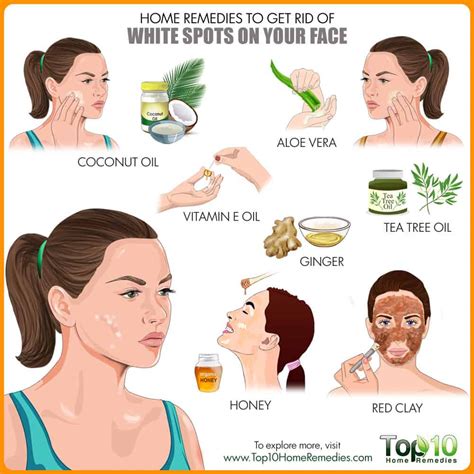 Small white spots on the skin is a condition known as idiopathic guttate hypomelanosis. Home Remedies to Get Rid of White Spots on Face | Top 10 ...