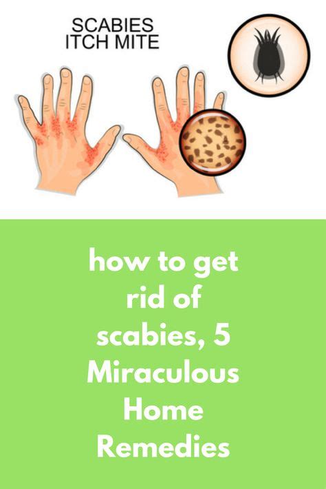 27 Rashes Remedies Ideas Rashes Remedies Scabies Scabies Treatment