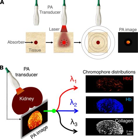An Overview Of Photoacoustic Pa Imaging With Spectral Unmixing As A