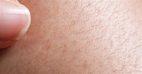 The skin over the legs can sometimes get dry, itchy and scaly! Natural Remedies for Extremely Dry Skin | LIVESTRONG.COM