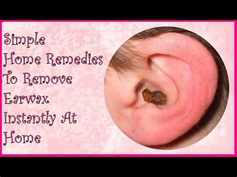 Earwax is produced by glands in the ear canal. Simple Home Remedies To Remove Earwax Instantly At Home ...