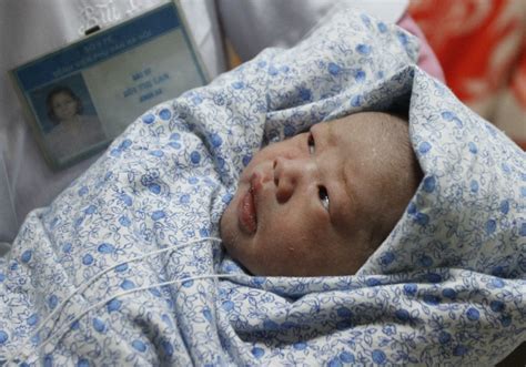 About their wedding, food, culture, clothing, anything. Miracle Baby Born With No Blood Survives