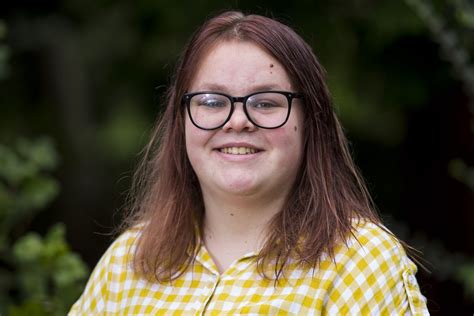 Doctors Baffled After Teen Girls Head Swells Up Like Beach Ball Real