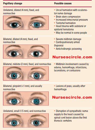 What Can Be The Causes Of Dilated And Fixed Pupils