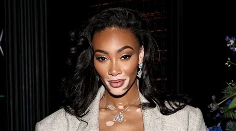 Winnie Harlow Explains Why She Almost Quit Modeling—and What Changed
