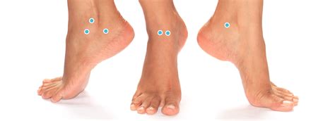 Find out all about peronei : Peroneus pees tendinose - Voetchirurgie