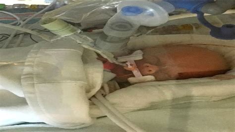 Baby Born To Mom Who Refused Cancer Treatment Has Died Abc7 Chicago