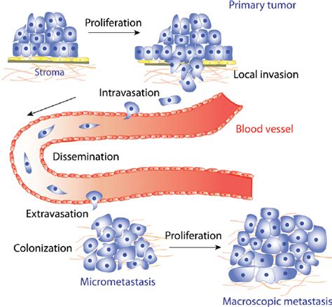 E Schematic Representation Of The Multiple Stages Of Metastatic