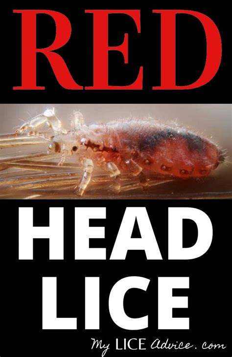 Red Lice Why Are Some Head Lice Red My Lice Advice