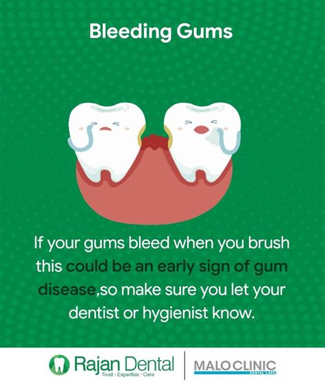 Dental Tips Bleeding Gums If Your Gums Bleed When You Brush This