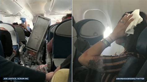 Severe Turbulence Rocks Flight From Oc Leading To Injuries And