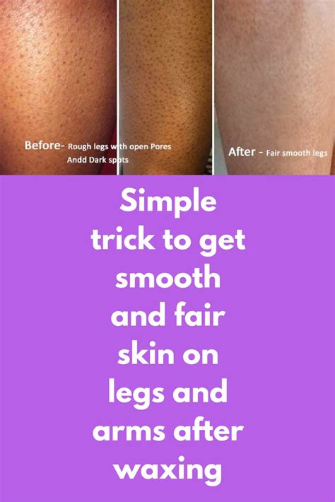 Simple Trick To Get Smooth And Fair Skin On Legs And Arms After Waxing