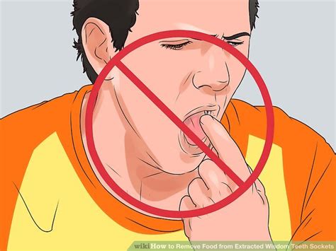 But you have to be extremely gentle and careful. How to Remove Food from Extracted Wisdom Teeth Sockets: 14 ...