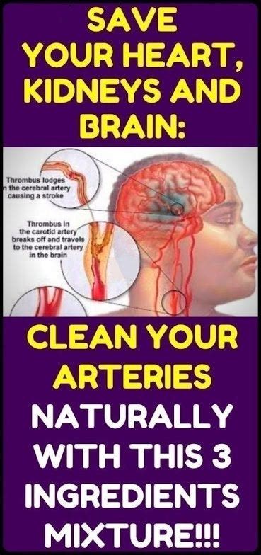 how to clean out plaque in arteries 3 ingredients mixture r medicaldailypress