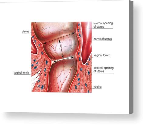 Postpartum Cervix Acrylic Print By Asklepios Medical Atlas