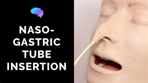 Nasogastric Ng Tube Insertion Osce Guide Youtube