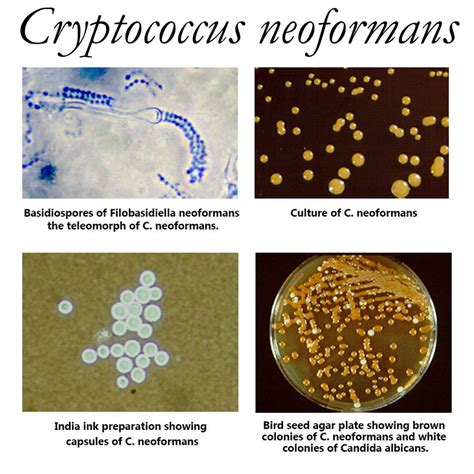 Department Of Microbiology Cryptococcus Neoformans