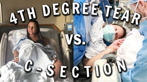 4th Degree Tear Recovery Vs C Section Recovery Youtube