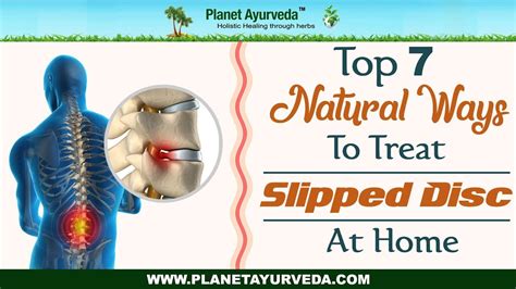 Top Natural Ways To Treat Slipped Disc At Home Youtube