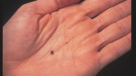 What Are Seed Ticks Parents Should Be On The Lookout This Summer