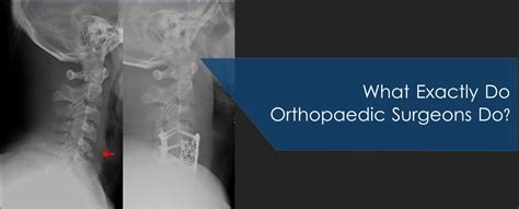 What Exactly Do Orthopaedic Surgeons Do Health In Motion