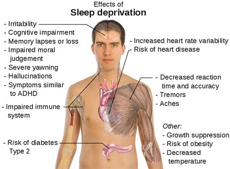 The Top 10 Effects Of Sleep Loss Perth Cpap