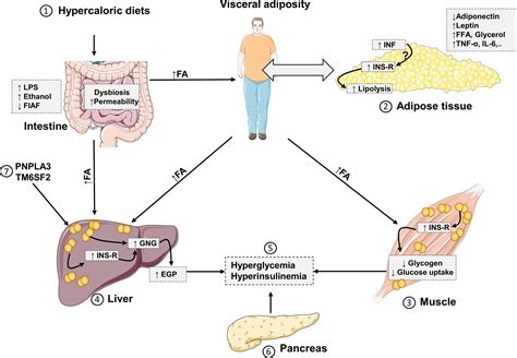 Metabolic Liver Disease In Diabetes From Mechanisms To Clinical Trials Metabolism Clinical