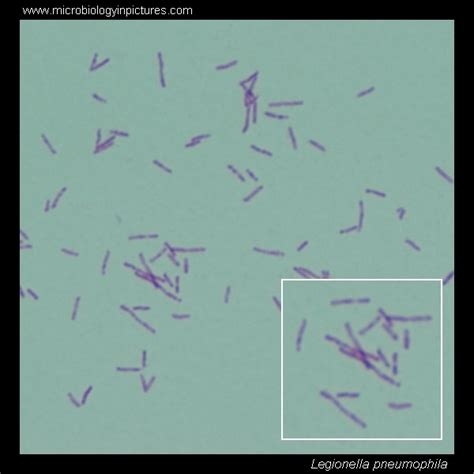 Legionella Gram Stain And Cell Morphologylegionella Micrograph
