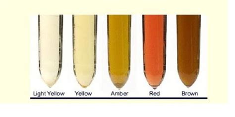 Health Significance Of Urine Colour Welcome To Infotainnet