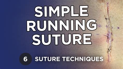 Simple Running Suture Learn Suture Techniques Youtube