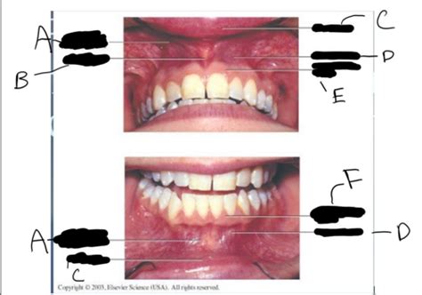 Tissues Of Oral Cavity Flashcards Quizlet