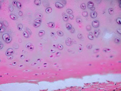 Hyaline Cartilage Hyaline Cartilage Microscopic Cells Histology