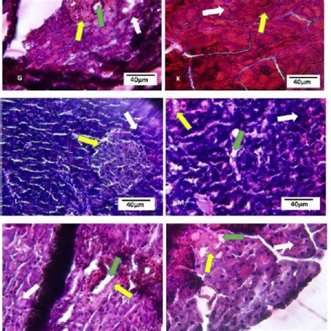 Histopathological Examinations Of The Liver Of Different Experimental