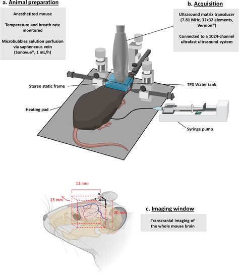 In Vivo Whole Brain Microvascular Imaging In Mice Using Transcranial 3d