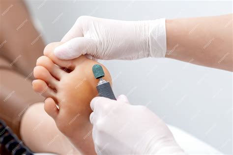 Premium Photo Peeling Feet Pedicure Procedure From Callus On Foot By