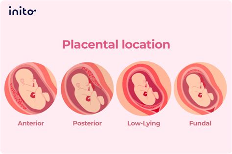 What Does It Mean To Have A Posterior Placenta Inito