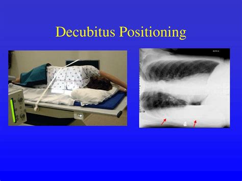 Ppt Reading The Cxr Powerpoint Presentation Free Download Id3651736