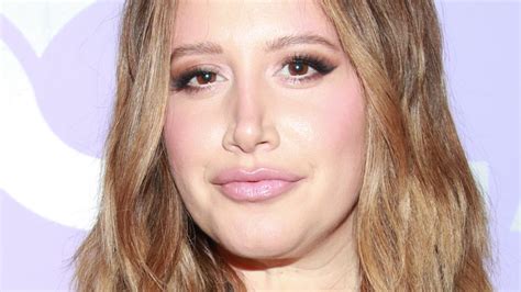 Ashley Tisdale Gets Honest About Her Struggle With Alopecia