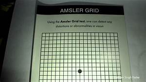 Amsler Grid Test Home Vision Test Youtube