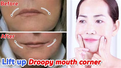 5 Mins Lift Up Droopy Mouth Corners Sagging Cheeks Massage No