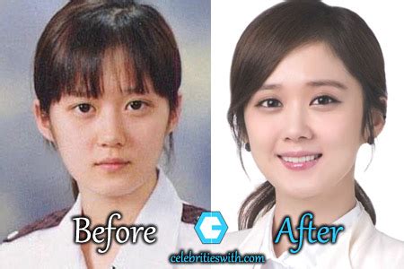 Jang nara plastic surgery rumors include eyelid surgery, nose job and botox injections. Jang Nara Plastic Surgery: Eyelid Surgery, Nose Job ...