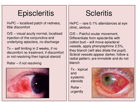 Eye Presentations To The Emergency Department