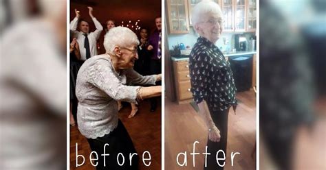 This 85 Year Old Woman Had A Hunchback For Decades This Fixed It