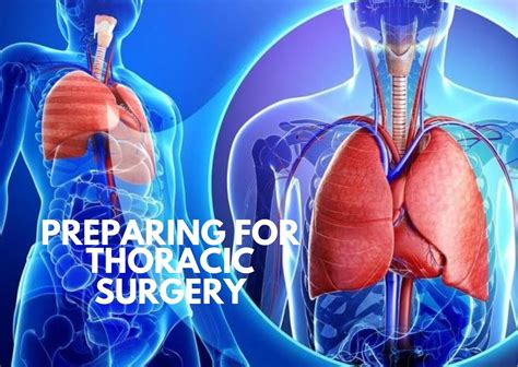 Preparing For Thoracic Surgery What You Need To Know The Operating Room Global Torg